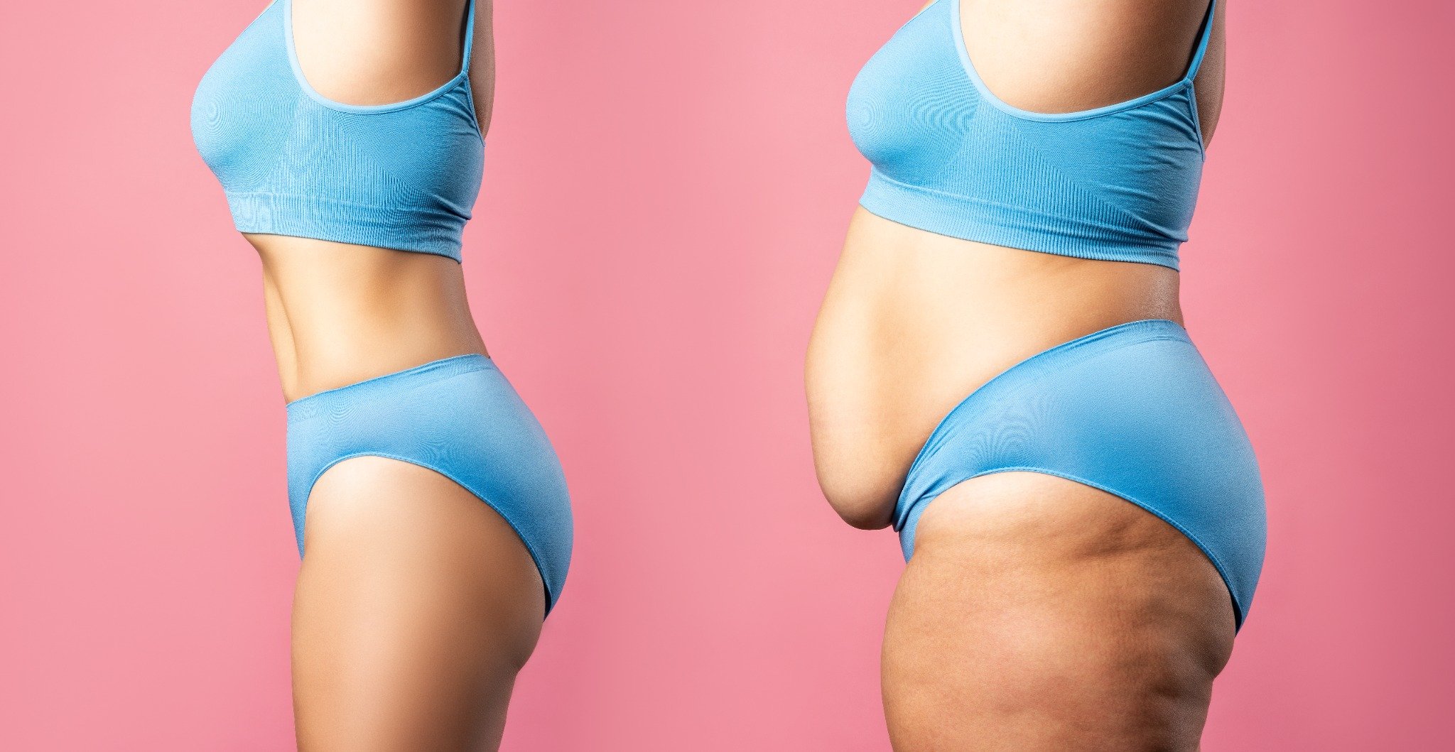 Catherine's Before and After Transformation