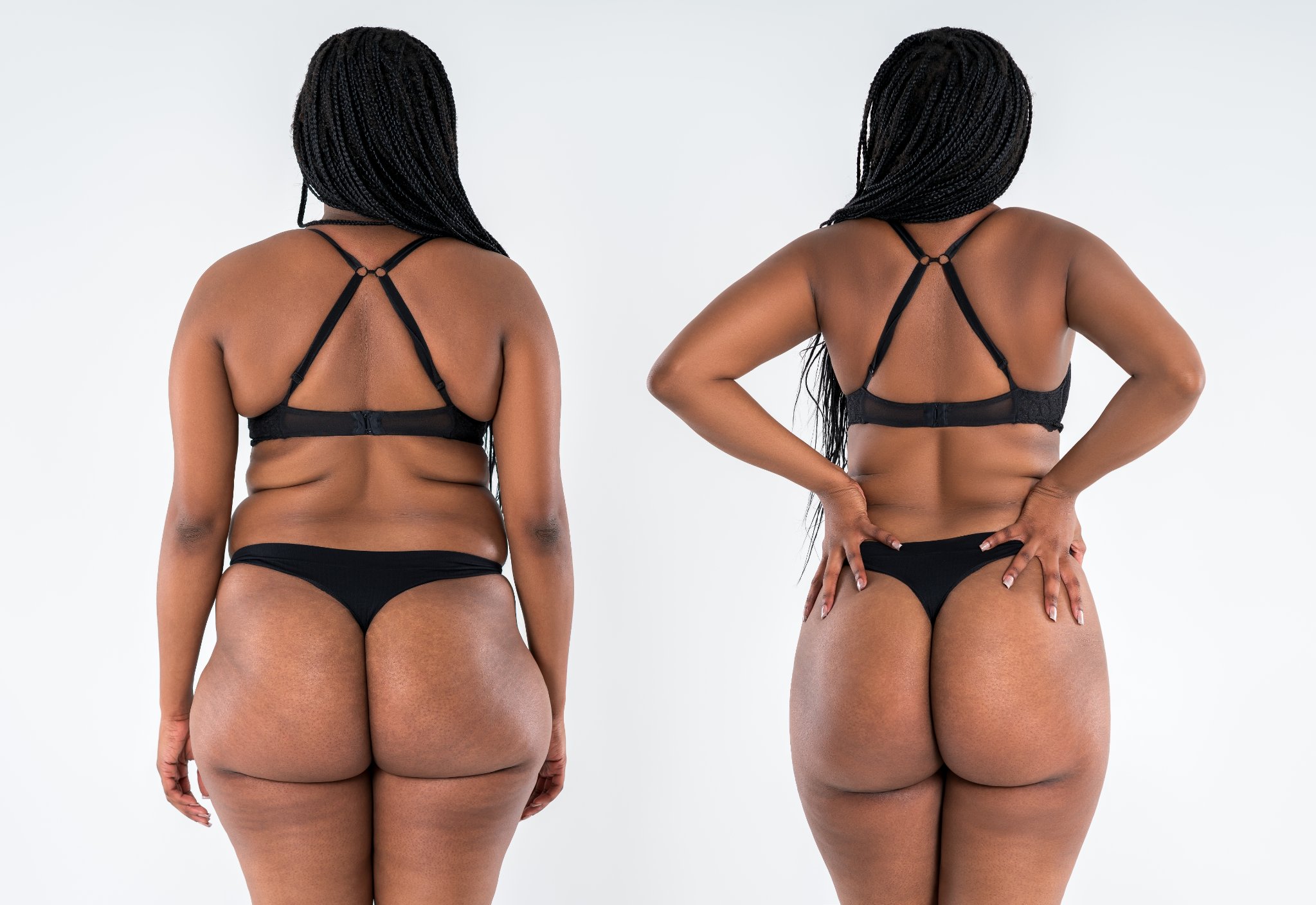 Melissa's Before and After Transformation